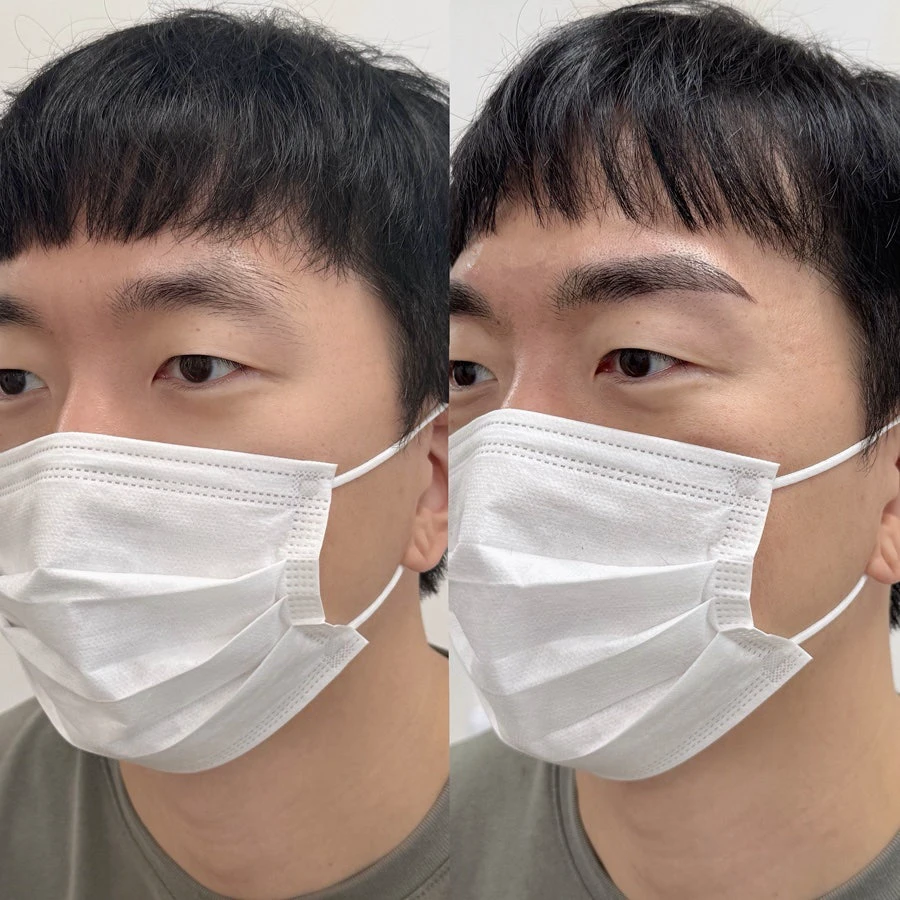 Male eyebrow comparison before and immediately after a semi-permanent brow procedure